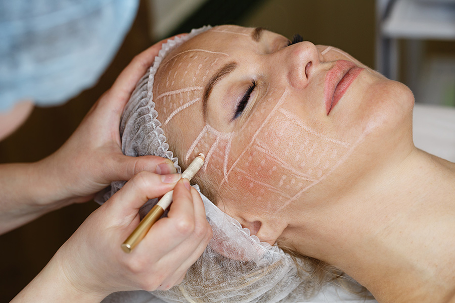 face lifting in Penrith.