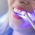 teeth whitening wollert