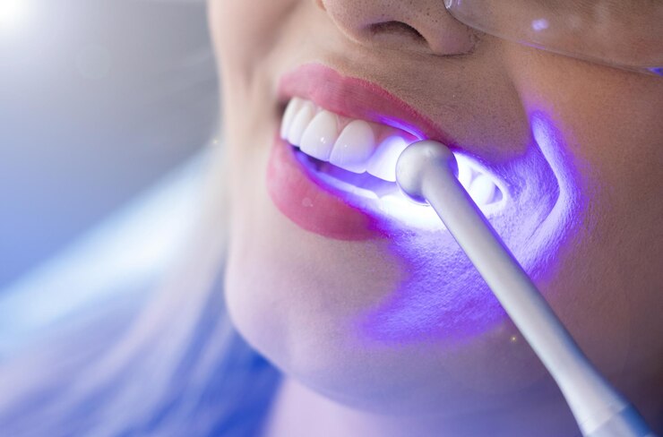 teeth whitening wollert