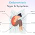 endometriosis symptoms