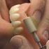 denture repair five dock