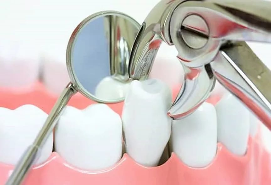 Teeth Extractions Granville: What Patients Need To Know