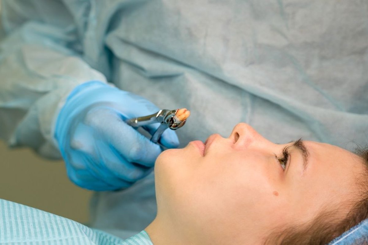 Wisdom Teeth Removal Parramatta: What Patients Need To Know