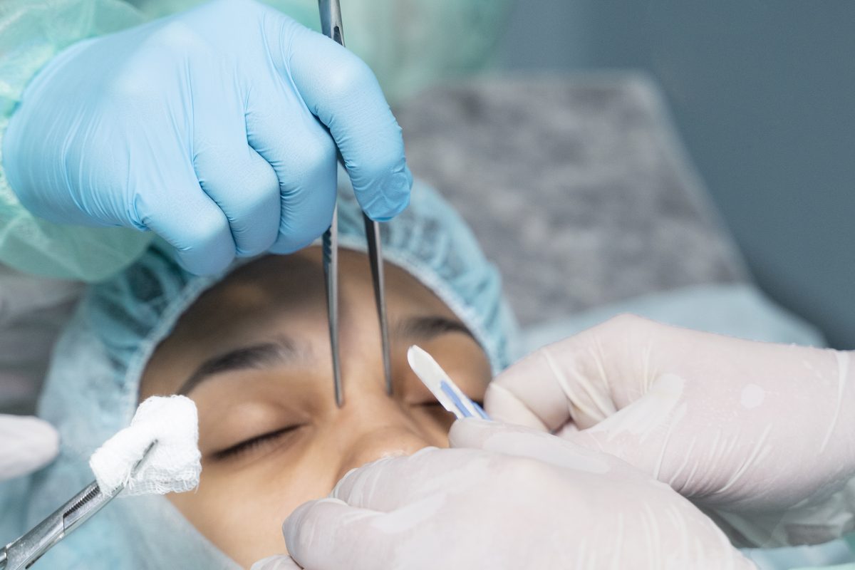 What Factors Determine Rhinoplasty Cost in Newport Beach?
